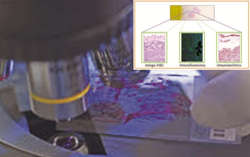 Strategie di ricerca e sviluppo per ottenere farmaci efficaci nella cura dei tumori e diagnosi di patologie ad alto impatto sociale