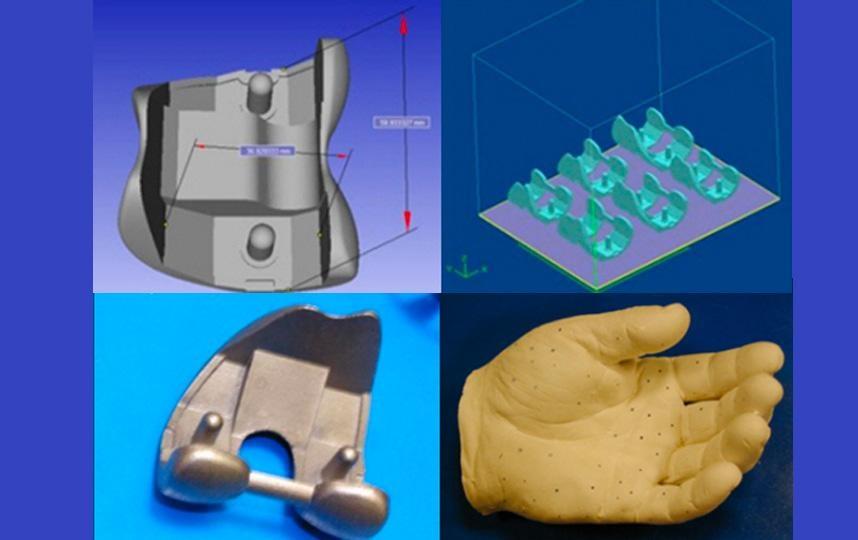 Tecnologie CAD/CAM: stampa 3D, modellazione CAD e ingegneria inversa nel settore biomedicale